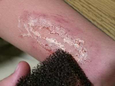 Рваная рана, своими руками =) !