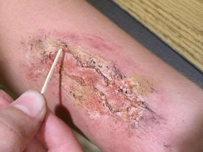 Рваная рана, своими руками =) !