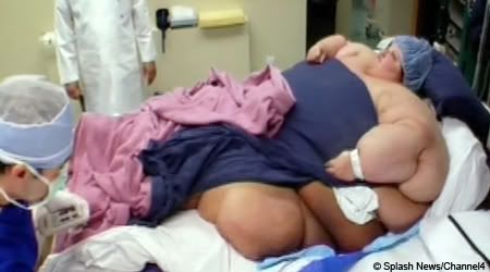 AussiE-media : Tragic story of worlds heaviest woman